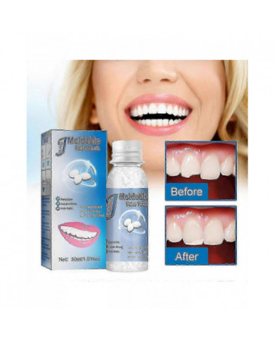 Kit de réparation dentaire temporaire Obturation dentaire Obturations perdues Bouchons de réparation Fausses dents