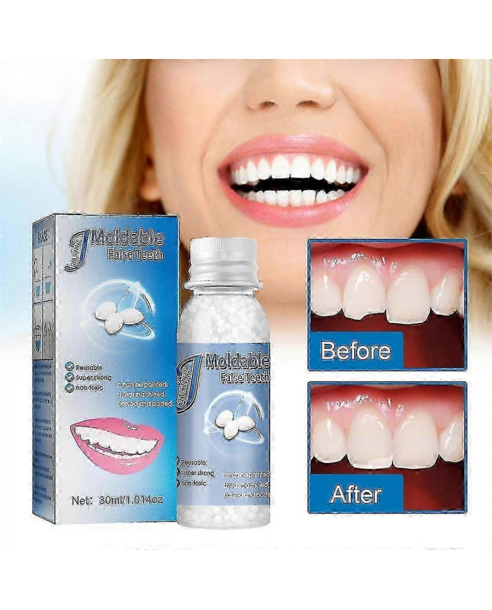 Kit de réparation dentaire temporaire Obturation dentaire Obturations perdues Bouchons de réparation Fausses dents