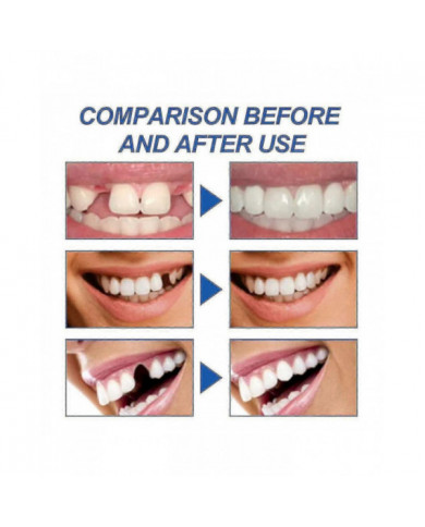 1-3x 2024 Nouveau Dents Fortes Réparation Dentaire Ciment Permanent Cavité De Ciment Dentaire Kit De Remplissage [...]