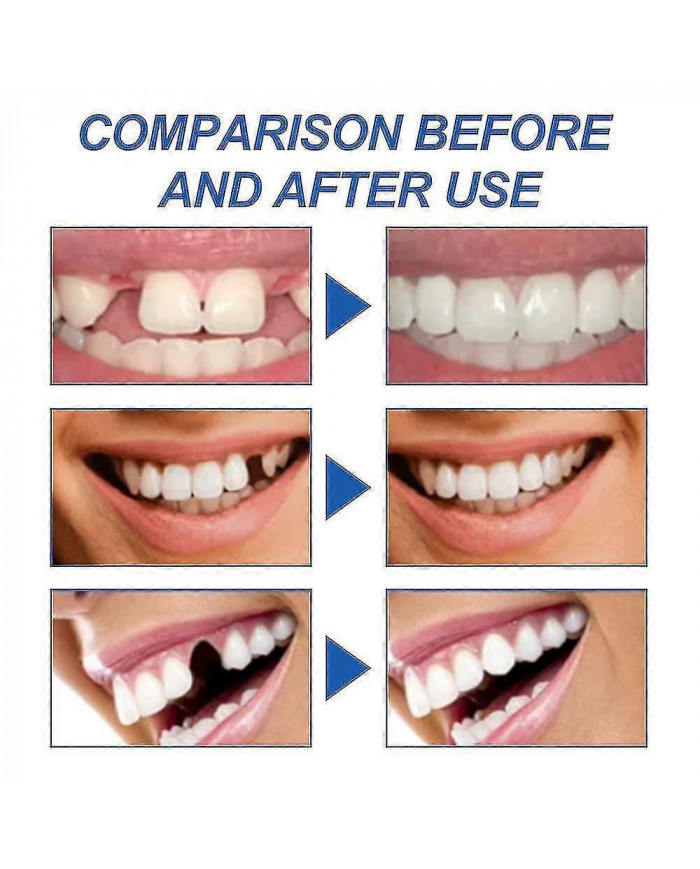 1-3x 2024 Nouveau Dents Fortes Réparation Dentaire Ciment Permanent Cavité De Ciment Dentaire Kit De Remplissage [...]